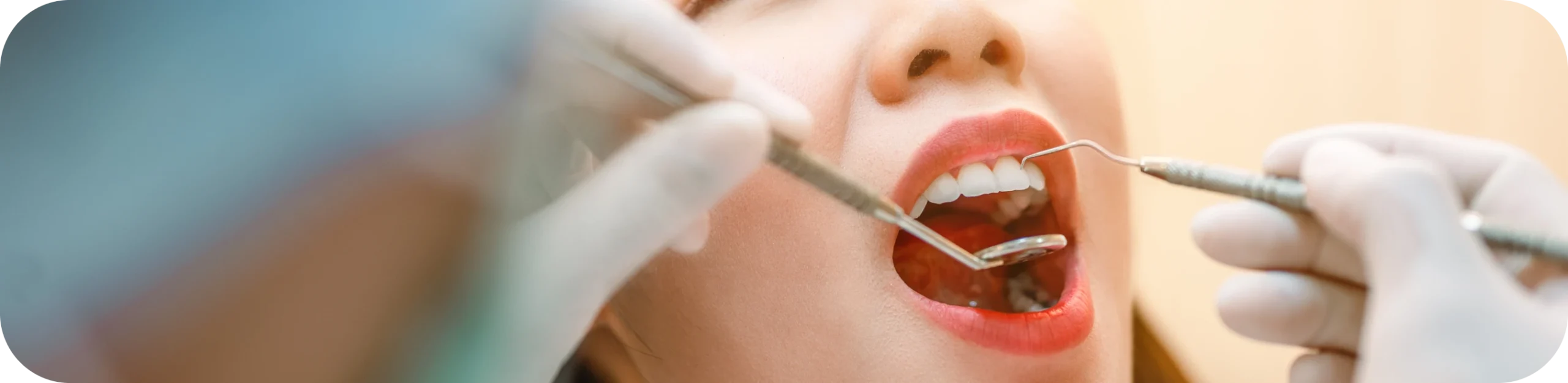 Dentistes à Montigny-le-Bretonneux, soins dentaires au cabinet I Can Smile