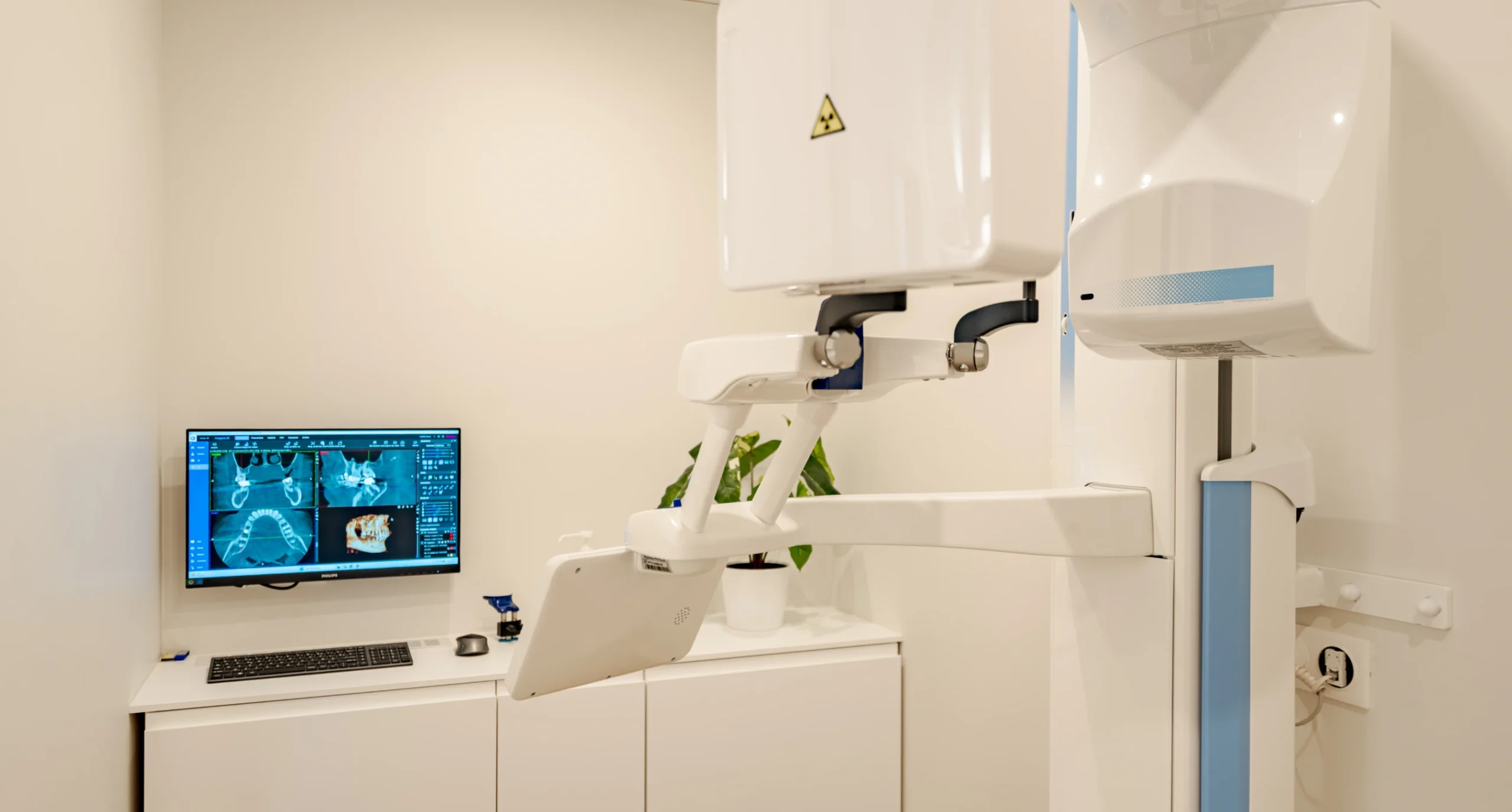 Appareil de radiologie 3D cone beam et son écran de contrôle